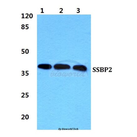 Anti-SSBP2 Antibody from Bioworld Technology (BS5946) - Antibodies.com