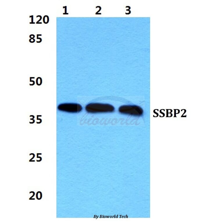 Anti-SSBP2 Antibody from Bioworld Technology (BS5946) - Antibodies.com