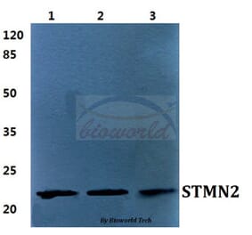 Anti-STMN2 Antibody from Bioworld Technology (BS5948) - Antibodies.com
