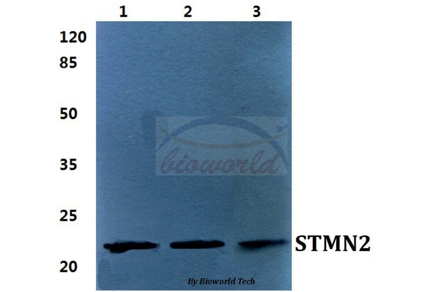 Anti-STMN2 Antibody from Bioworld Technology (BS5948) - Antibodies.com