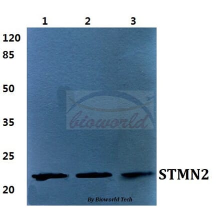 Anti-STMN2 Antibody from Bioworld Technology (BS5948) - Antibodies.com