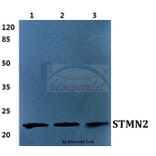 Anti-STMN2 Antibody from Bioworld Technology (BS5948) - Antibodies.com