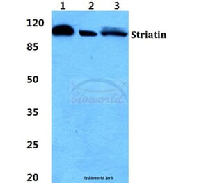 Anti-Striatin Antibody from Bioworld Technology (BS5949) - Antibodies.com