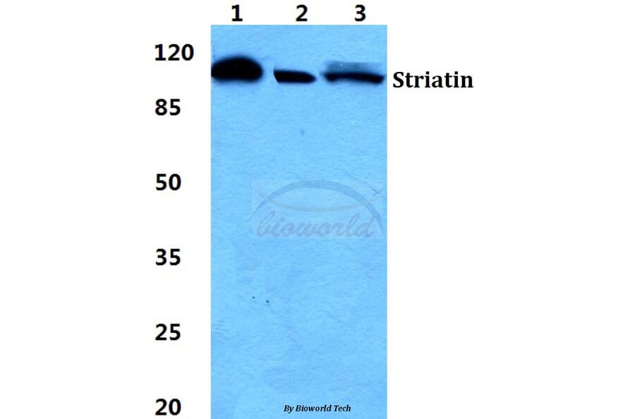 Anti-Striatin Antibody from Bioworld Technology (BS5949) - Antibodies.com