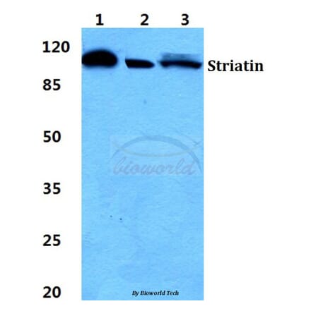 Anti-Striatin Antibody from Bioworld Technology (BS5949) - Antibodies.com