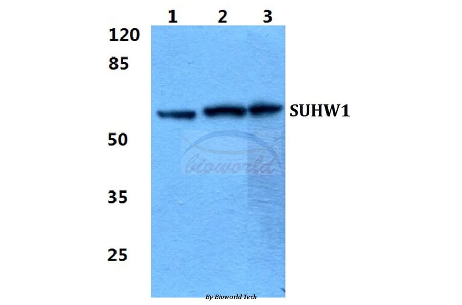 Anti-SUHW1 Antibody from Bioworld Technology (BS5951) - Antibodies.com