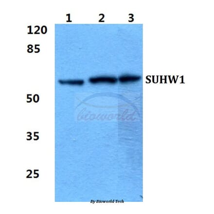 Anti-SUHW1 Antibody from Bioworld Technology (BS5951) - Antibodies.com