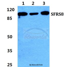 Anti-SFRS8 Antibody from Bioworld Technology (BS5952) - Antibodies.com