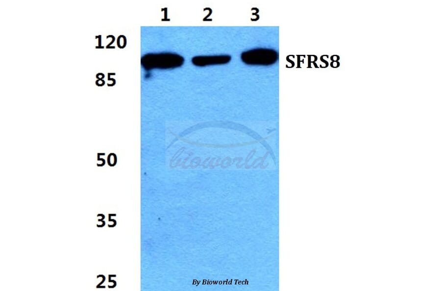 Anti-SFRS8 Antibody from Bioworld Technology (BS5952) - Antibodies.com