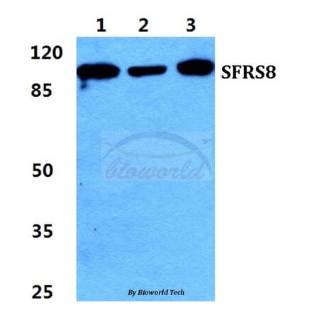 Anti-SFRS8 Antibody from Bioworld Technology (BS5952) - Antibodies.com