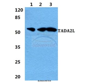 Anti-TADA2L Antibody from Bioworld Technology (BS5953) - Antibodies.com