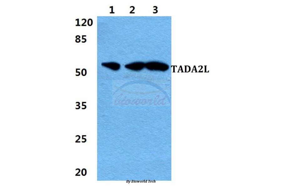 Anti-TADA2L Antibody from Bioworld Technology (BS5953) - Antibodies.com