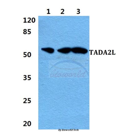 Anti-TADA2L Antibody from Bioworld Technology (BS5953) - Antibodies.com