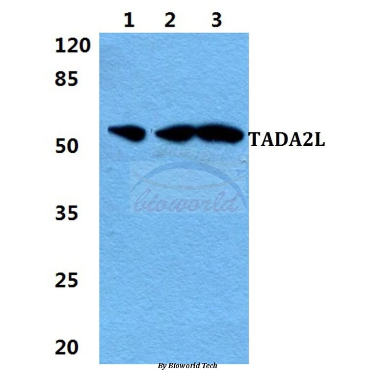 Anti-TADA2L Antibody from Bioworld Technology (BS5953) - Antibodies.com