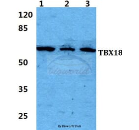 Anti-TBX18 Antibody from Bioworld Technology (BS5955) - Antibodies.com