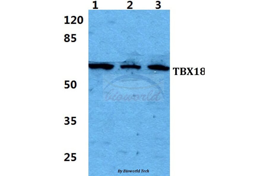 Anti-TBX18 Antibody from Bioworld Technology (BS5955) - Antibodies.com