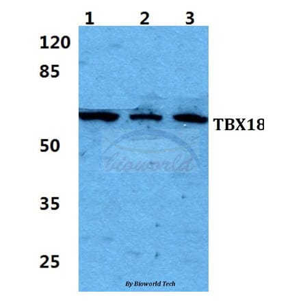 Anti-TBX18 Antibody from Bioworld Technology (BS5955) - Antibodies.com