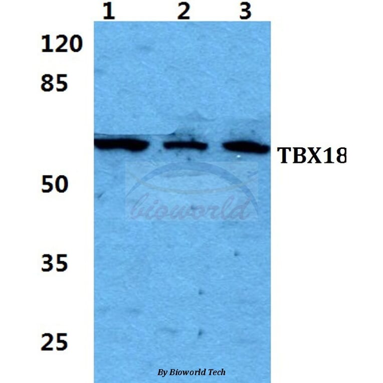 Anti-TBX18 Antibody from Bioworld Technology (BS5955) - Antibodies.com