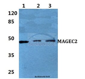 Anti-MAGEC2 Antibody from Bioworld Technology (BS5956) - Antibodies.com