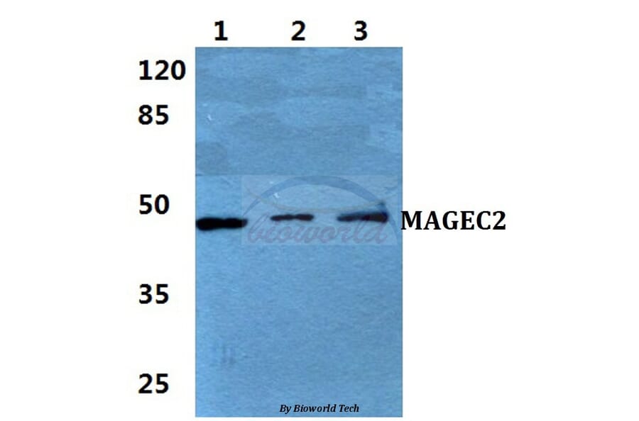 Anti-MAGEC2 Antibody from Bioworld Technology (BS5956) - Antibodies.com