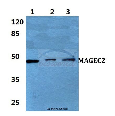 Anti-MAGEC2 Antibody from Bioworld Technology (BS5956) - Antibodies.com