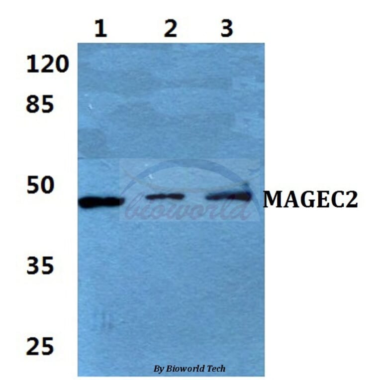 Anti-MAGEC2 Antibody from Bioworld Technology (BS5956) - Antibodies.com