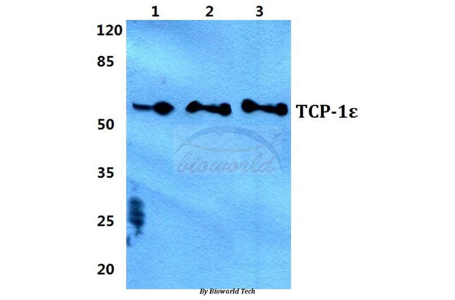 Anti-TCP-1ε Antibody from Bioworld Technology (BS5958) - Antibodies.com