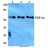 Anti-TCP-1ε Antibody from Bioworld Technology (BS5958) - Antibodies.com