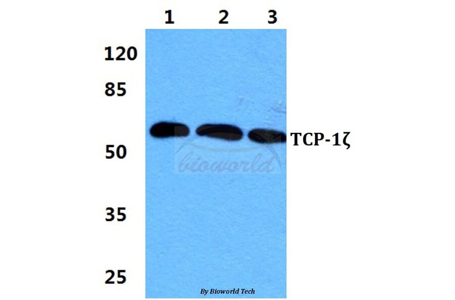 Anti-TCP-1ζ Antibody from Bioworld Technology (BS5959) - Antibodies.com