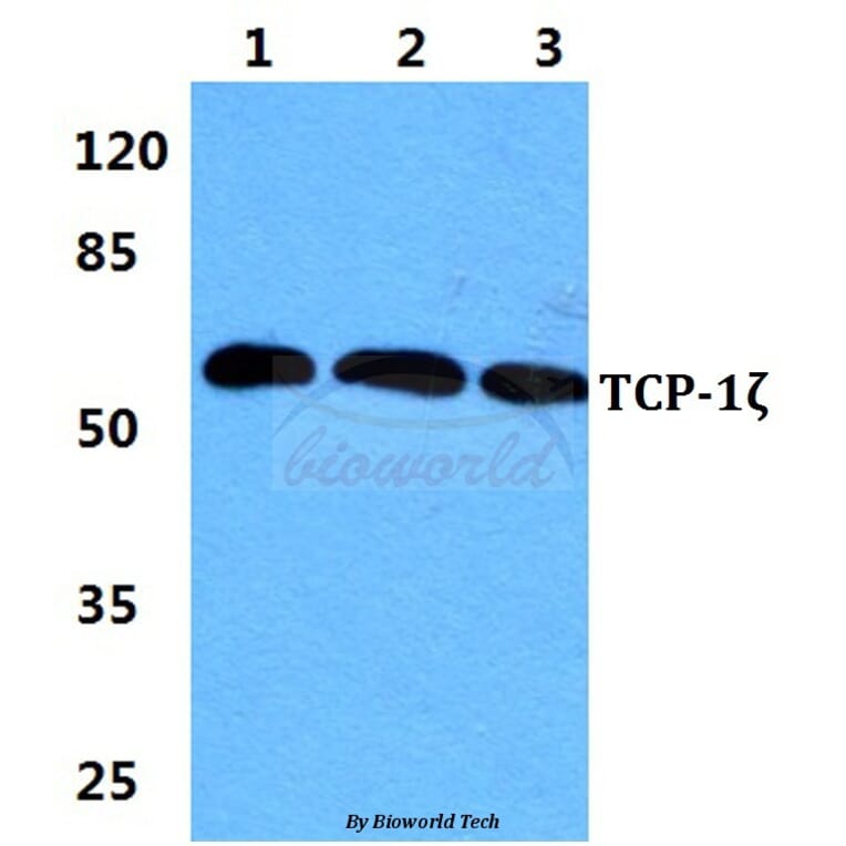 Anti-TCP-1ζ Antibody from Bioworld Technology (BS5959) - Antibodies.com