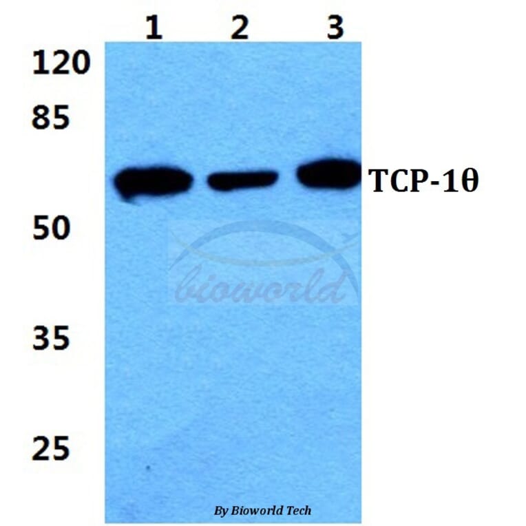 Anti-TCP-1θ Antibody from Bioworld Technology (BS5960) - Antibodies.com