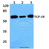 Anti-TCP-1θ Antibody from Bioworld Technology (BS5960) - Antibodies.com