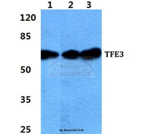 Anti-TFE3 Antibody from Bioworld Technology (BS5962) - Antibodies.com