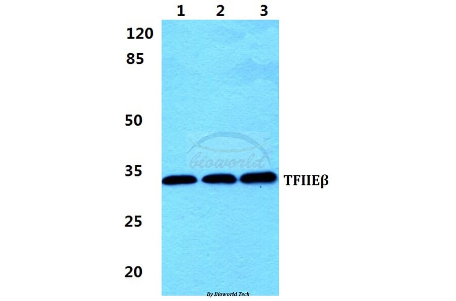 Anti-TFIIE-β Antibody from Bioworld Technology (BS5964) - Antibodies.com