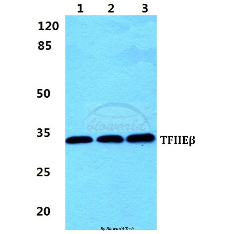Anti-TFIIE-β Antibody from Bioworld Technology (BS5964) - Antibodies.com