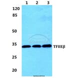 Anti-TFIIE-β Antibody from Bioworld Technology (BS5964) - Antibodies.com