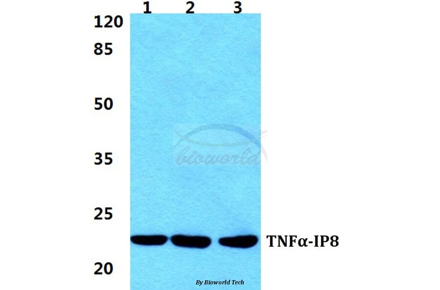 Anti-TNFα-IP8 Antibody from Bioworld Technology (BS5965) - Antibodies.com