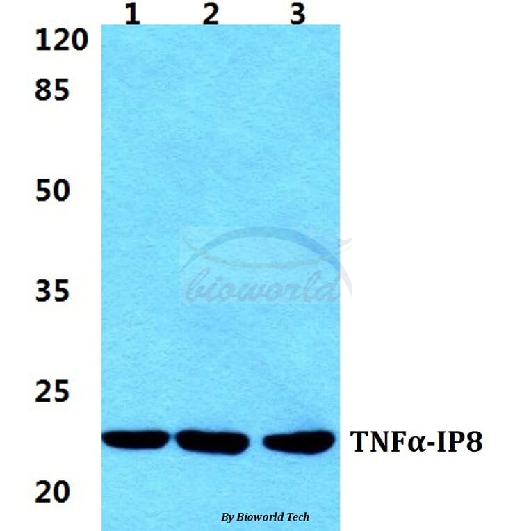 Anti-TNFα-IP8 Antibody from Bioworld Technology (BS5965) - Antibodies.com