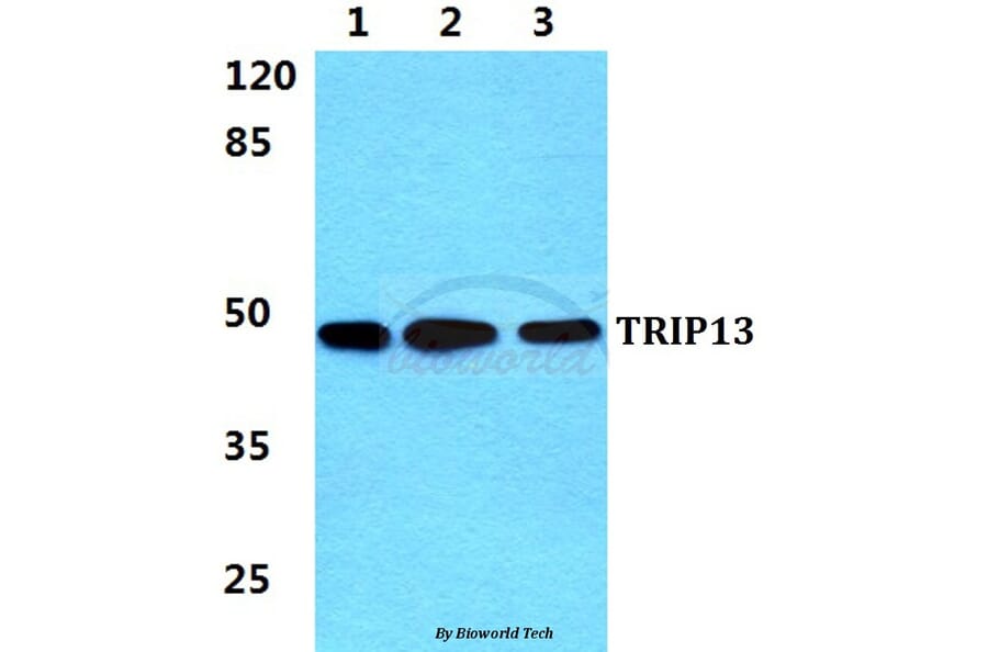 Anti-TRIP13 Antibody from Bioworld Technology (BS5967) - Antibodies.com