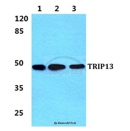 Anti-TRIP13 Antibody from Bioworld Technology (BS5967) - Antibodies.com