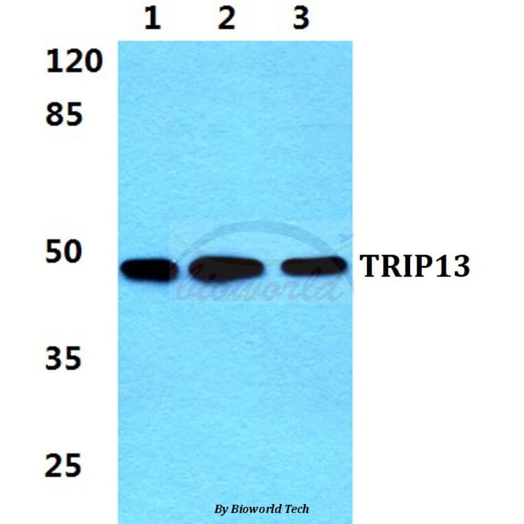 Anti-TRIP13 Antibody from Bioworld Technology (BS5967) - Antibodies.com