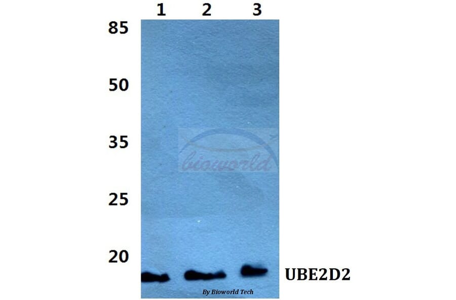 Anti-UBE2D2 Antibody from Bioworld Technology (BS5969) - Antibodies.com