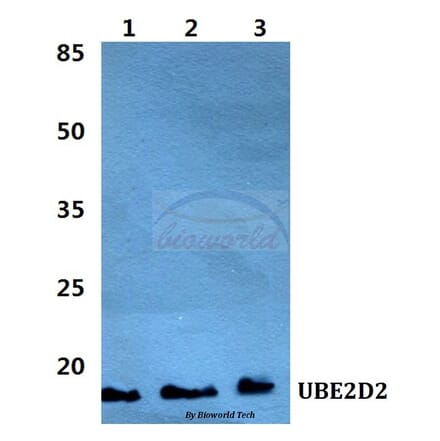 Anti-UBE2D2 Antibody from Bioworld Technology (BS5969) - Antibodies.com