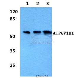 Anti-ATP6V1B1 Antibody from Bioworld Technology (BS5976) - Antibodies.com
