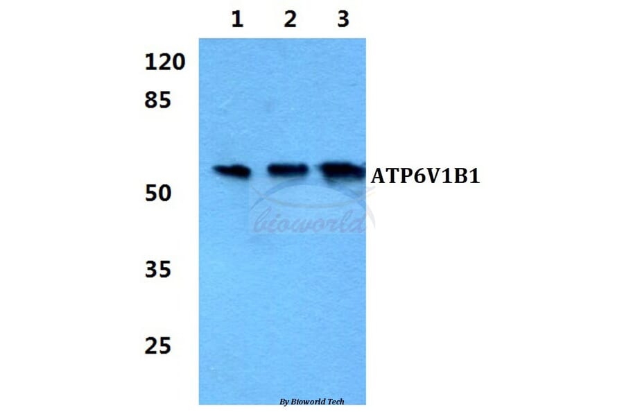 Anti-ATP6V1B1 Antibody from Bioworld Technology (BS5976) - Antibodies.com
