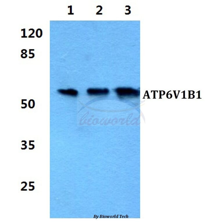 Anti-ATP6V1B1 Antibody from Bioworld Technology (BS5976) - Antibodies.com
