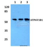 Anti-ATP6V1B1 Antibody from Bioworld Technology (BS5976) - Antibodies.com