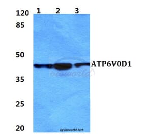 Anti-ATP6V0D1 Antibody from Bioworld Technology (BS5977) - Antibodies.com