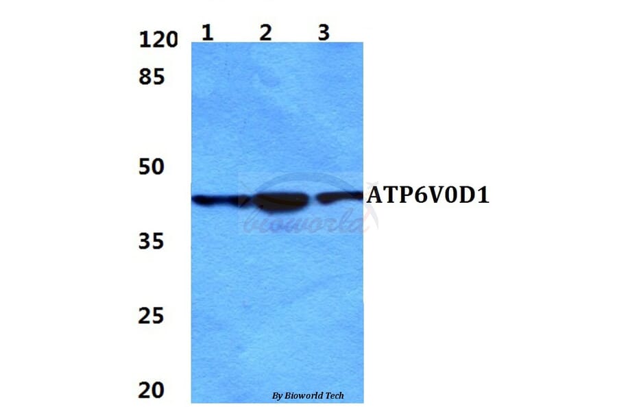 Anti-ATP6V0D1 Antibody from Bioworld Technology (BS5977) - Antibodies.com