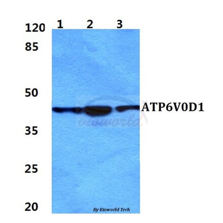 Anti-ATP6V0D1 Antibody from Bioworld Technology (BS5977) - Antibodies.com